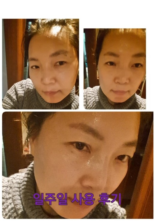 케이엔에이 이미지