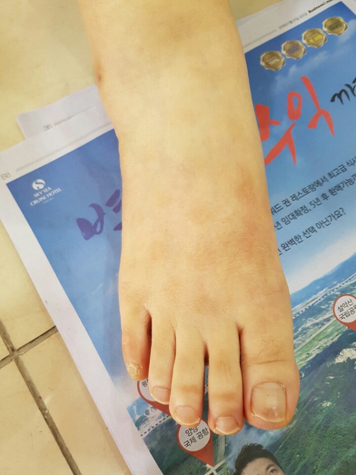 발로니아 이미지