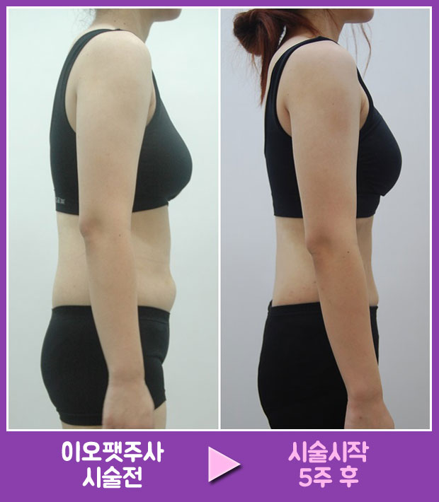 이오그룹 이미지