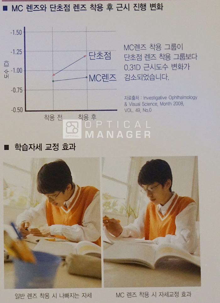 엠씨렌즈 이미지