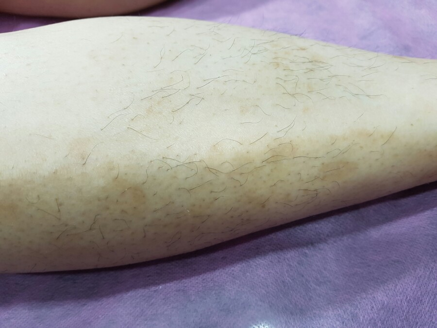 윤블리 이미지