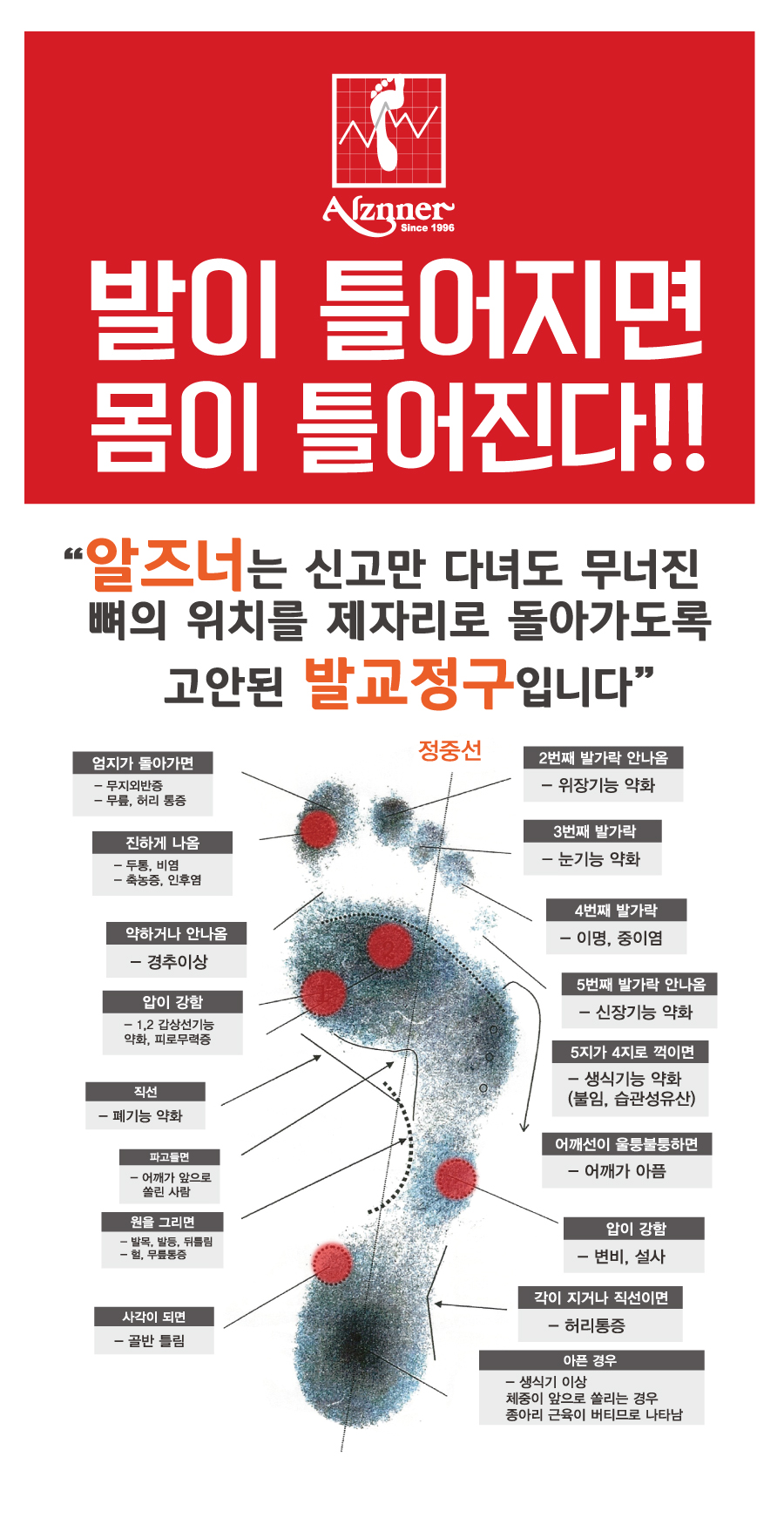 알즈너 명품발 대리점 이미지