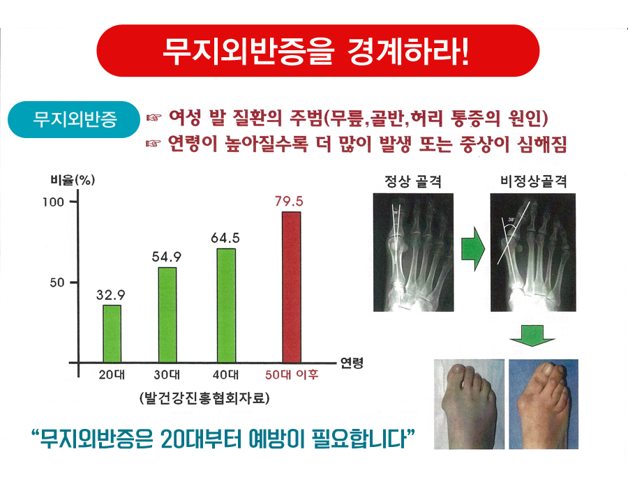 알즈너 명품발 대리점 이미지