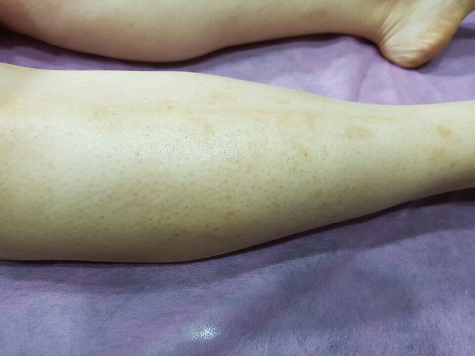 윤블리뷰티 이미지