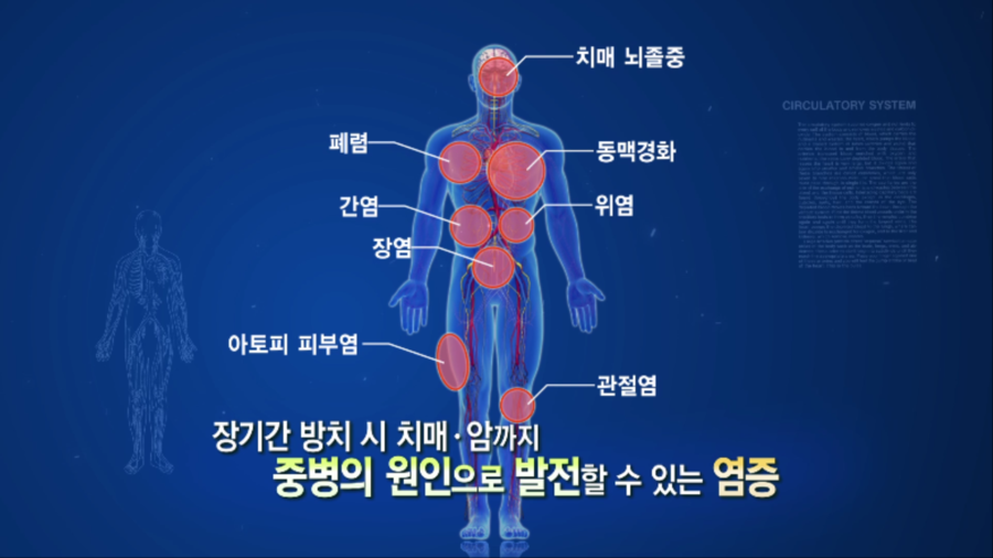 스마일화분 이미지