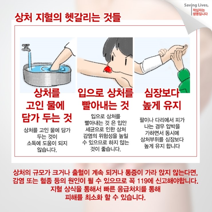 [응급처치 상식] 상처 지혈 및 응급처치 : 네이버 블로그