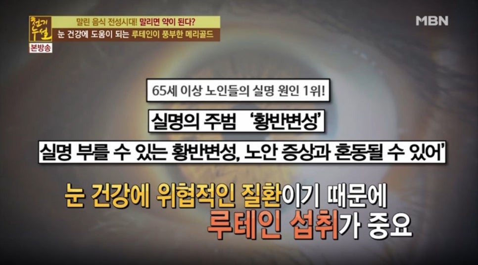 세이프아이 이미지