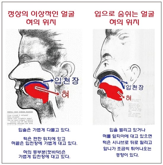 서울리더스치과 이미지