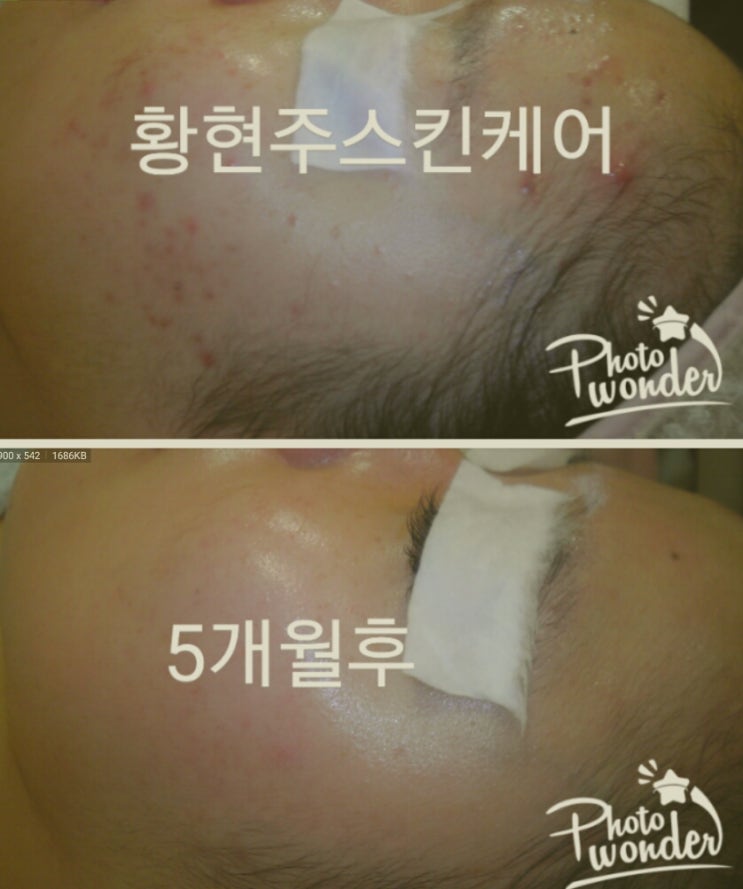 피디티 이미지