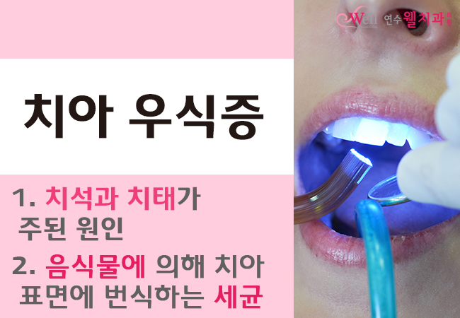 연수웰치과 이미지