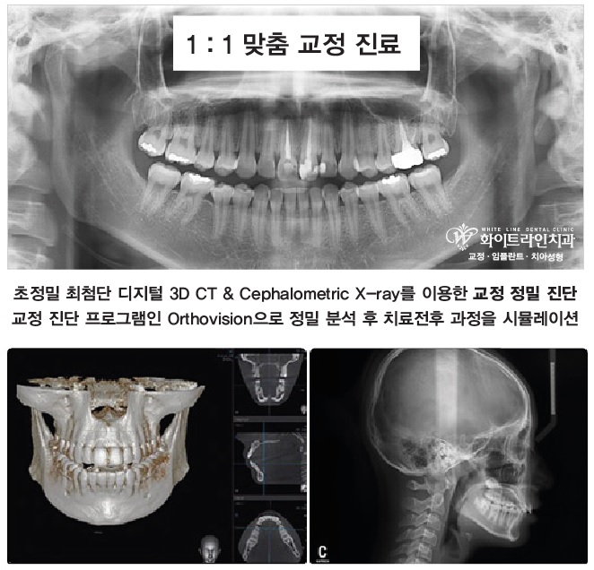 화이트라인치과 이미지