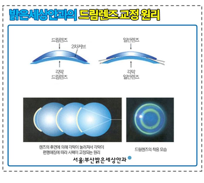 고쳐드림 이미지