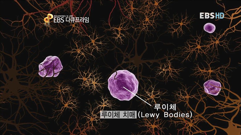 루이체 이미지