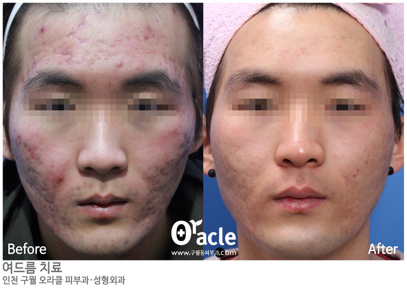 오라클피부과 이미지