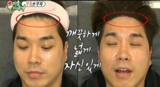슈가링바이지 이미지