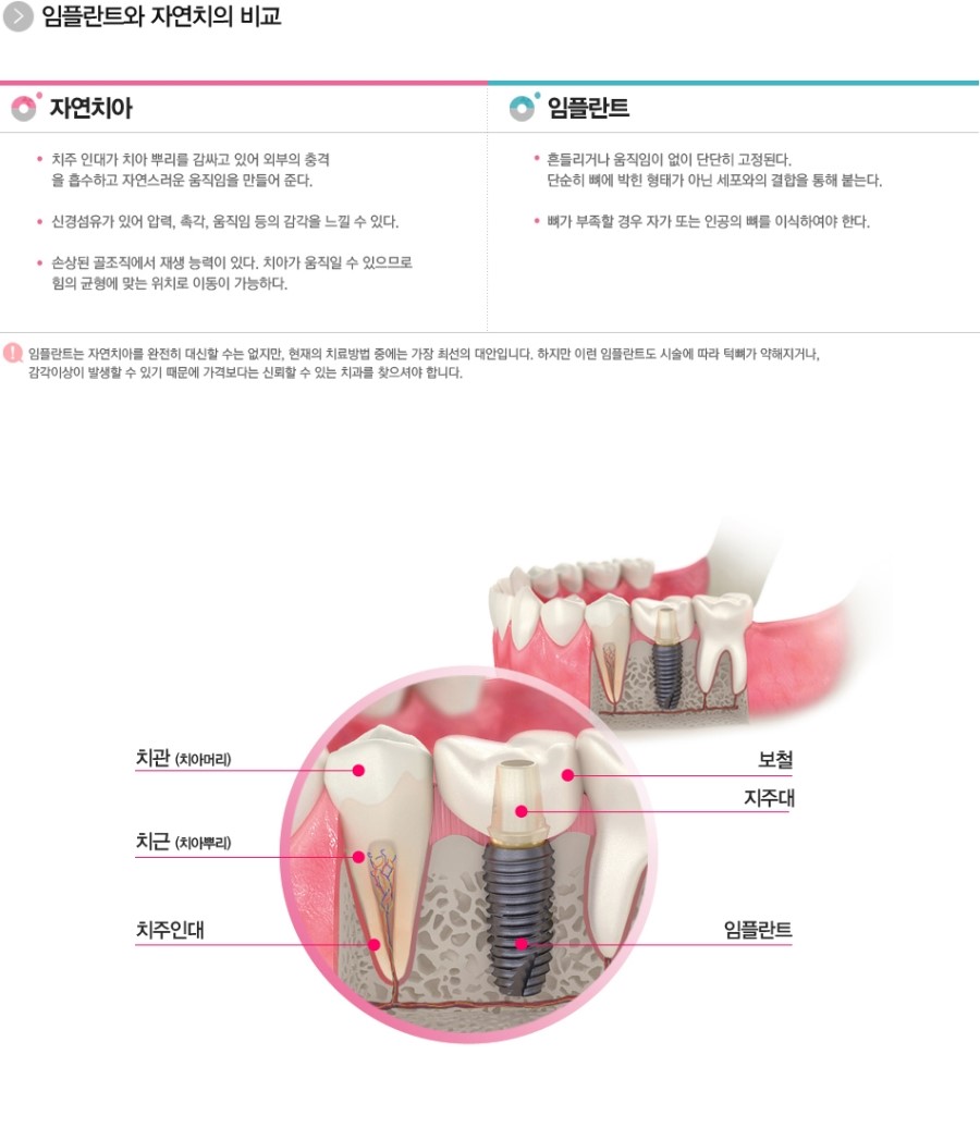 스마트치과 이미지