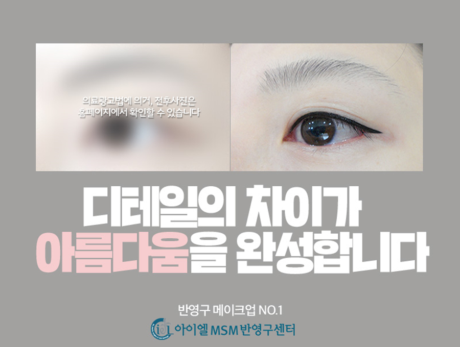 미헤어라인 이미지