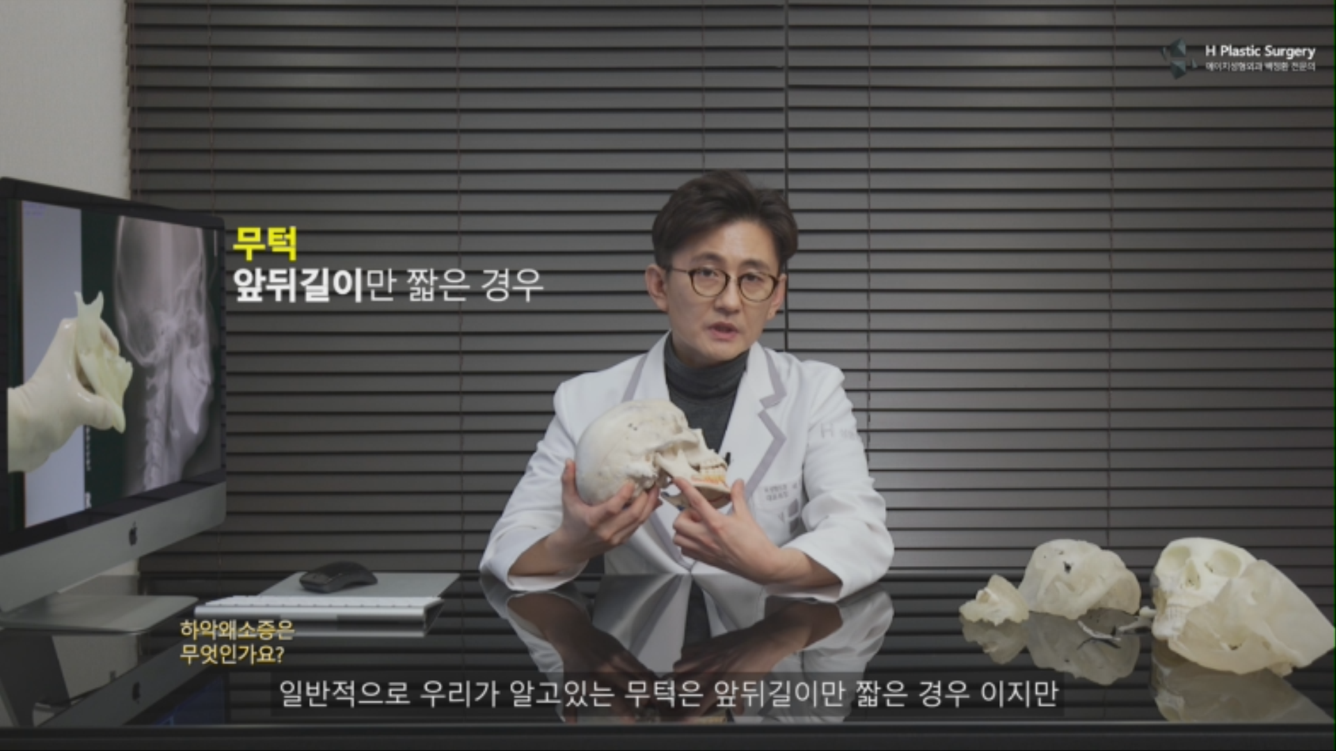 이에 반해 무턱은 하악의 상하길이는 비교적 정상인 반면 앞뒤 길이가 작은 경우 입니다.