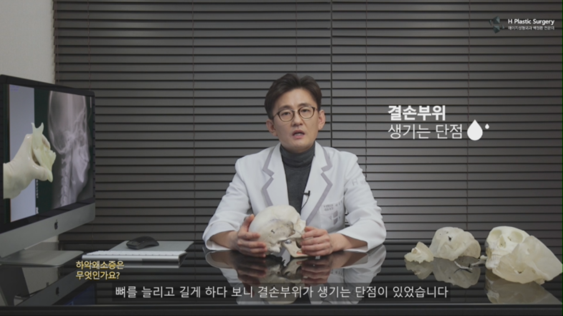 하지만, 이러한 삼악 수술은 부족한 뼈를 반으로 갈라서 부족한 길이를 보완하고, 턱끝의 뼈를 전진시켜 보완하는 방식으로 수술하기에 필연적으로 결손 부위가 생기는 단점을 가지고 있습니다. 이에 대한 자세한 내용은 아래 링크글 확인 하시기 바랍니다. http://blog.