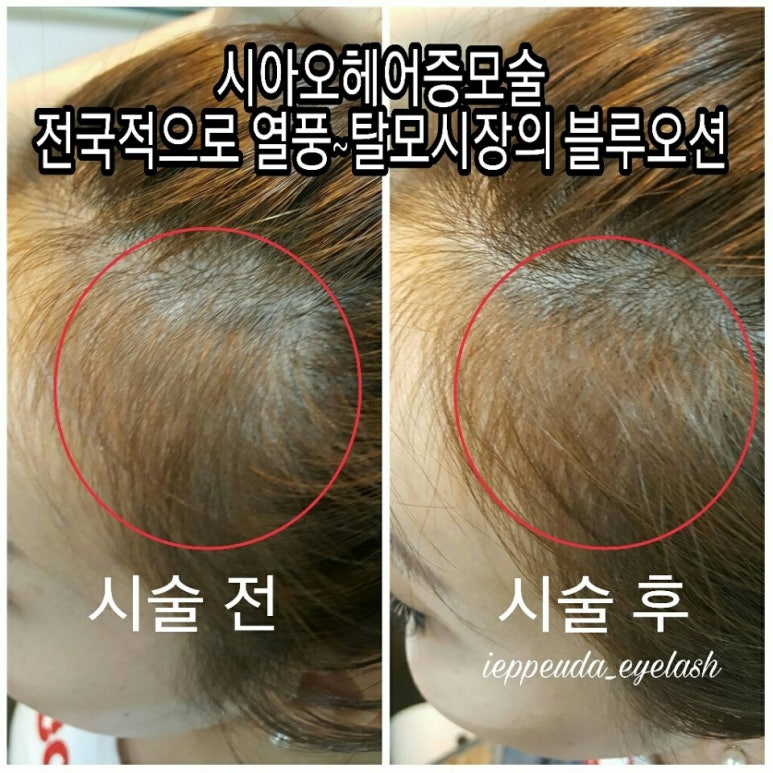 아이이쁘다뷰티 이미지