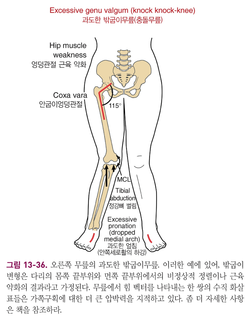 마르페인 이미지