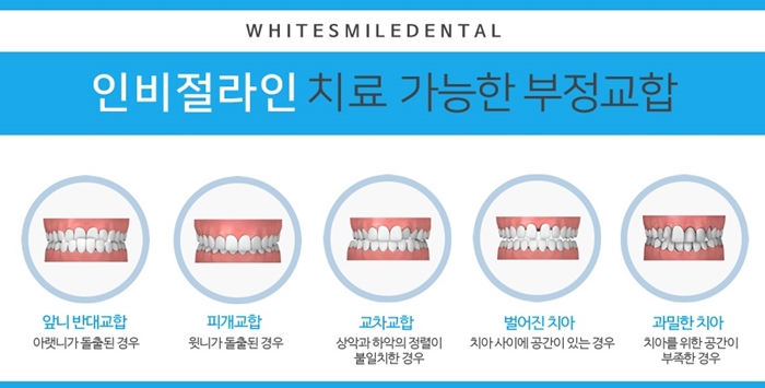 청주으뜸치과 이미지