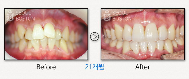보스톤미소치과 이미지