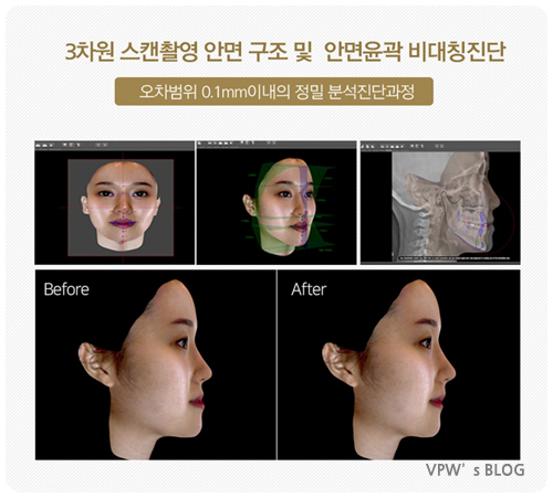 로덴치과 이미지
