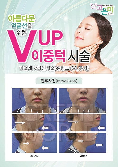 고은미클리닉 이미지
