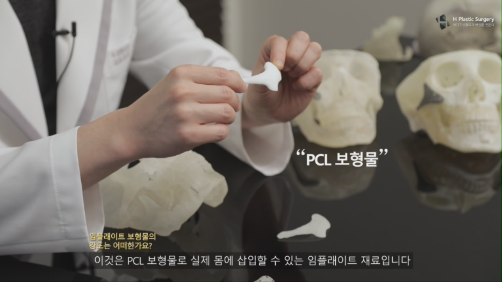 위 사진은 폴리머 (PCL or PCL+TCP) Implate 보형물의 모습입니다.