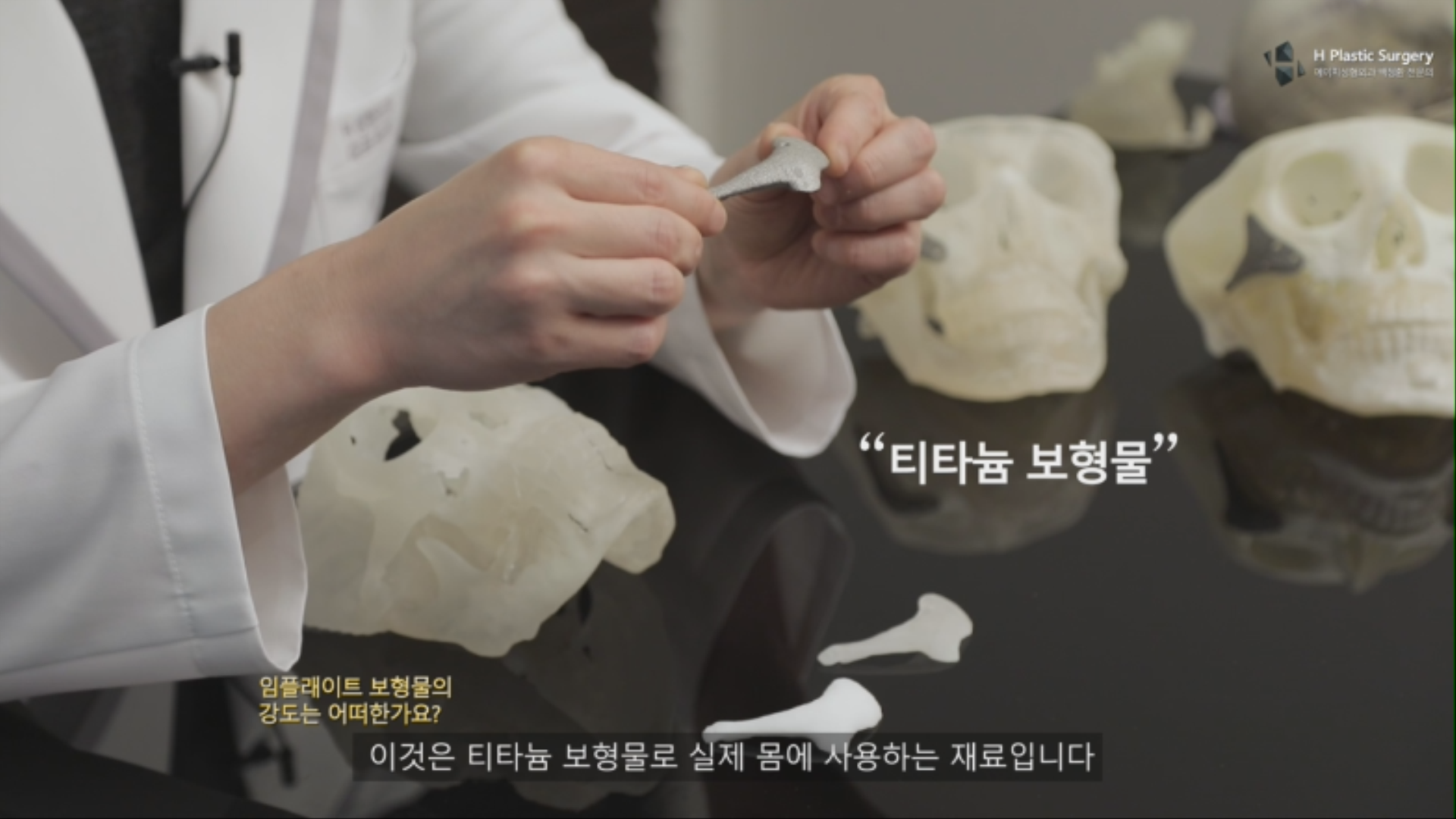 위 사진은 티타늄 (Titanium) Implate 보형물의 모습입니다.