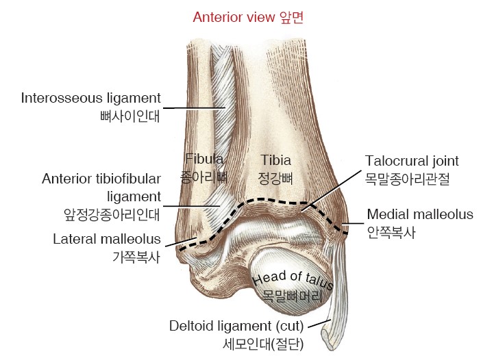 마르페인 이미지