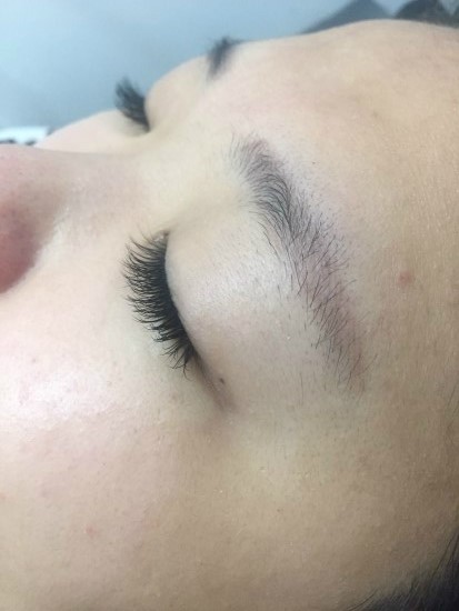 EYE이뻐 이미지