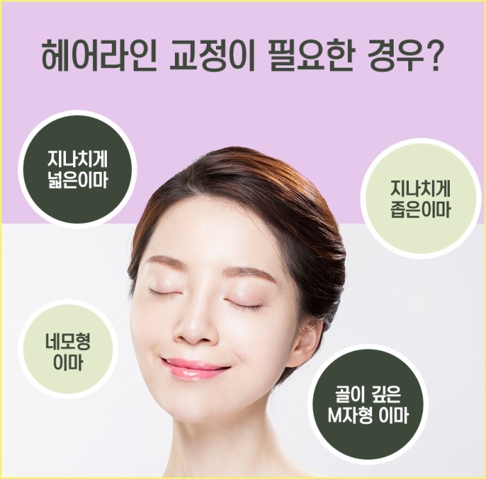 미헤어라인 이미지