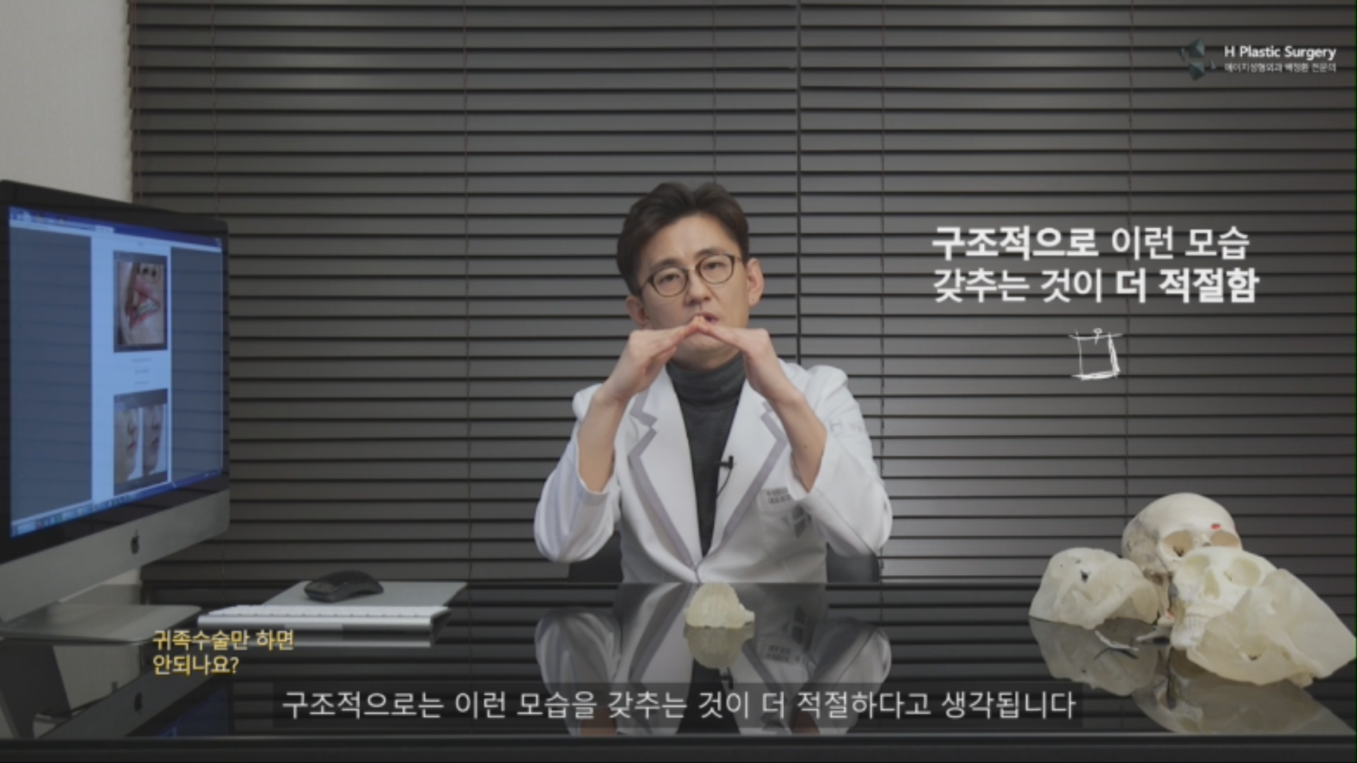 따라서 귀족 부분에 볼륨을 많이 교정하면서 구조적으로 정상에 가까운 형태를 유지하려면 고양이 부위가 같이 수술이 되는 노블캣보형물이 필요하게 됩니다. . 관련내용에 대한 추가적인 설명은 아래 링크에서 확인하시기 바랍니다. http://blog.naver.com/ys10