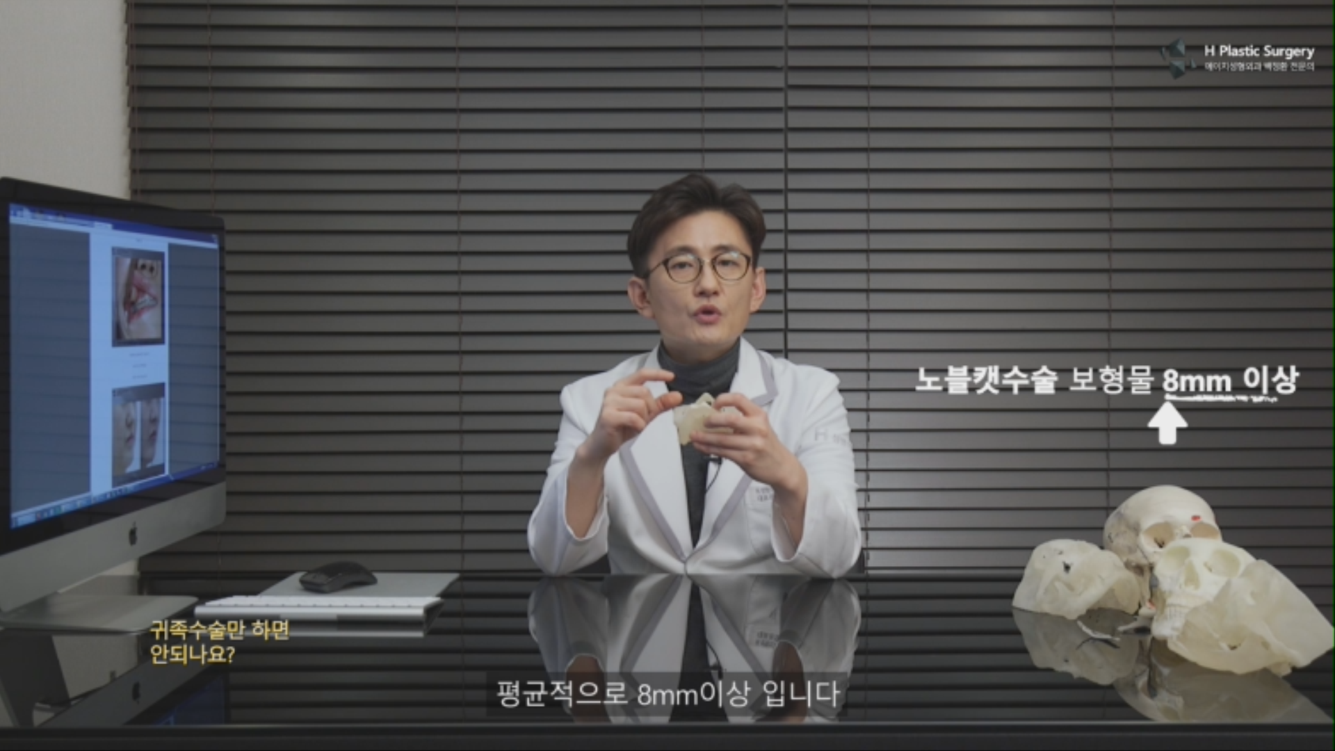 하지만, 제가 주로 쓰는 3DFit PMMA 노블캣 보형물은 8mm 이상이 대부분 입니다.