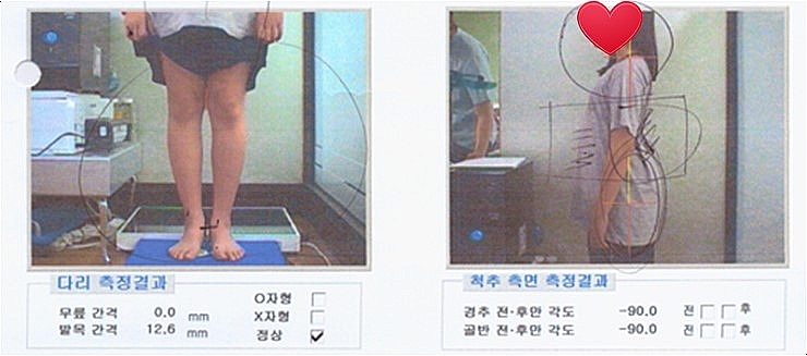 키네스 이미지