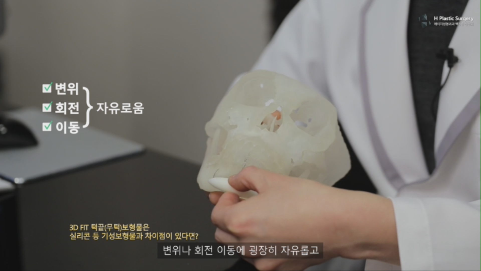 따라서 보형물의 변위, 회전, 이동 에 자유롭게 됩니다.