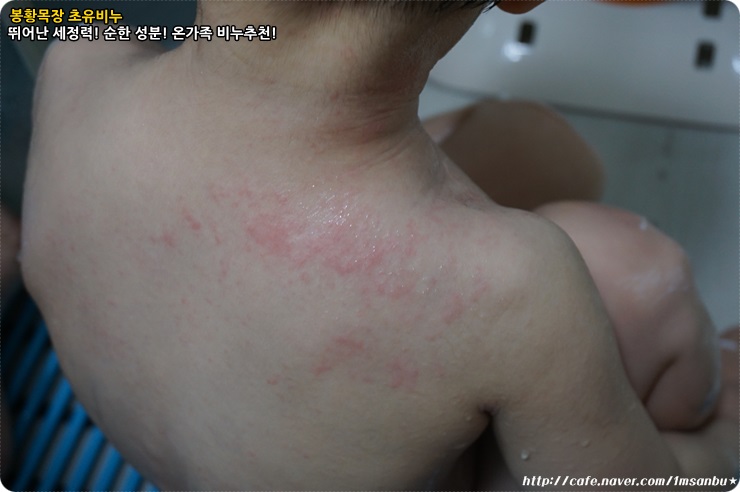 봉황스킨케어 이미지