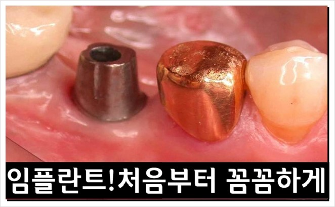 뉴욕화이트치과 이미지
