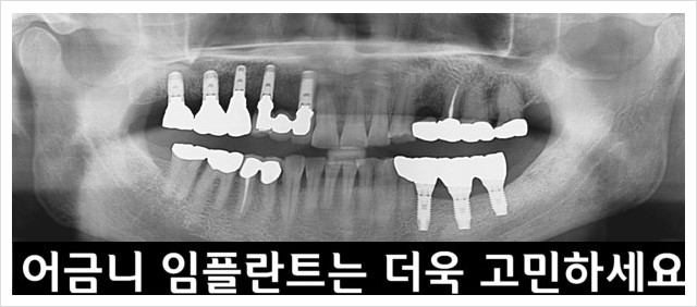 뉴욕화이트치과 이미지