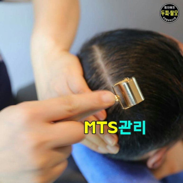 엠지에프두피탈모전문센터 이미지