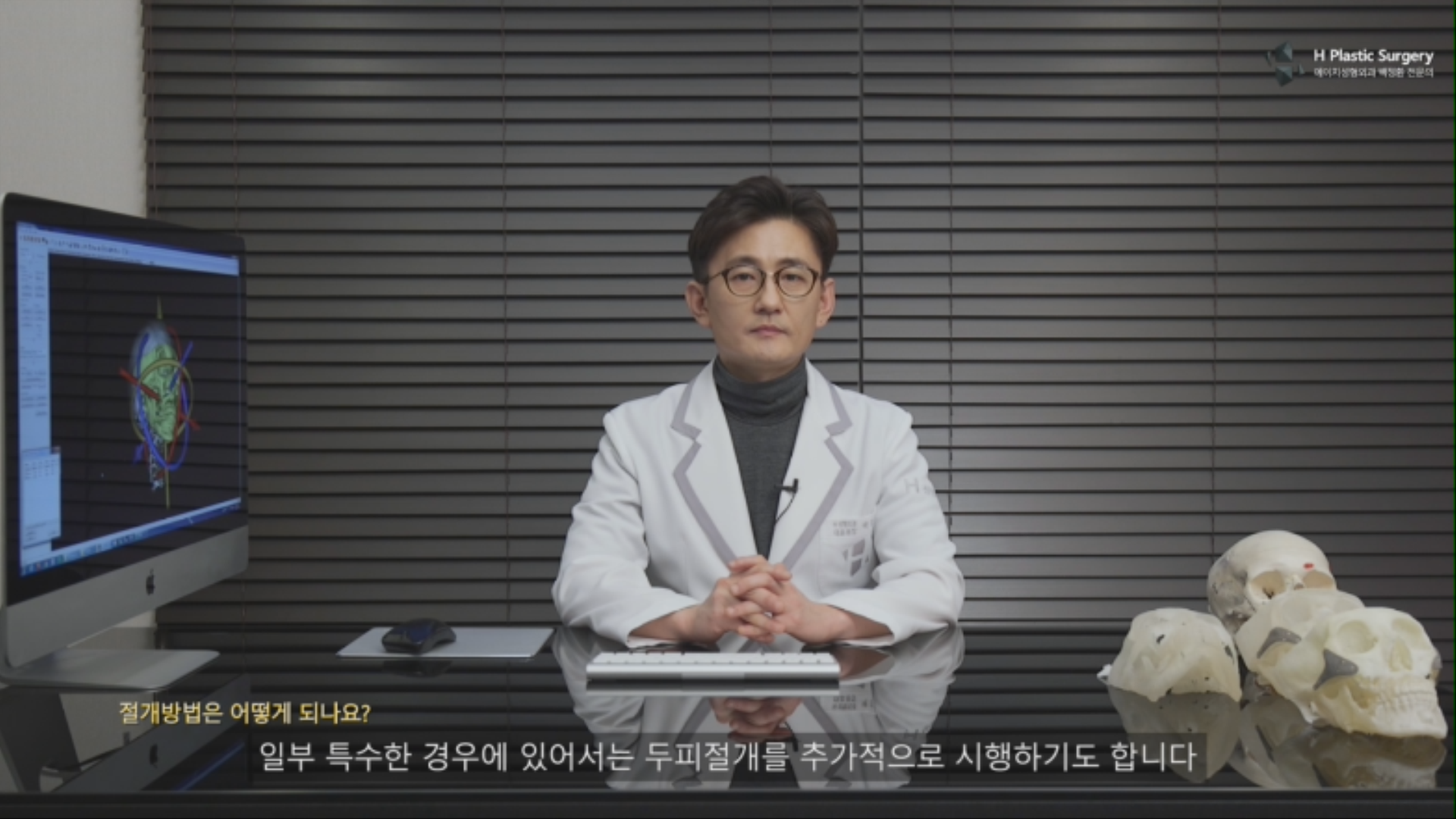 일부 환자의 경우 필요시에는 두피절개를 통해 수술을 진행하기도 합니다. 다만, 추가적인 상처와 안면유지인대 손상을 예방하기 위해 가능한 입안절개와 구레나룻 절개를 통해 수술하는 것을 원칙으로 하고 있습니다.