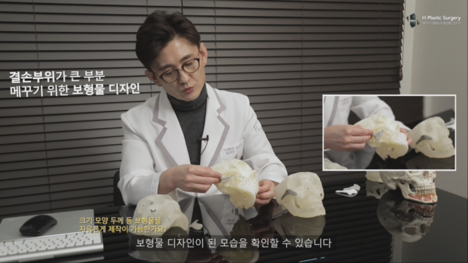 결손부위를 메꾸면서 옆광대를 줄이는 디자인을 하였습니다.