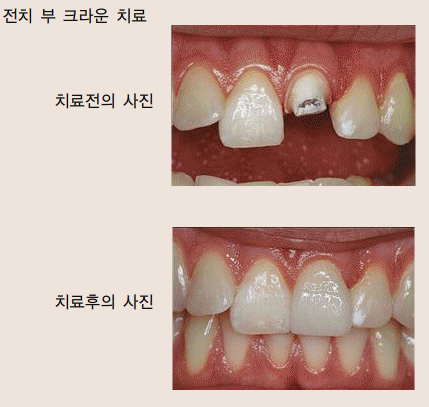 미시건치과 이미지