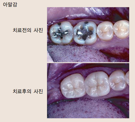 미시건치과 이미지