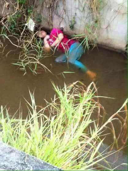 힉 이미지