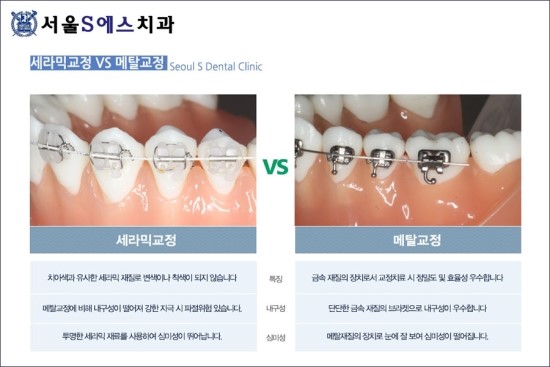 서울에스치과서울S치과 이미지