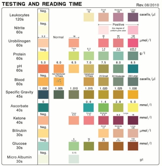 What Is Sg In Urine Test