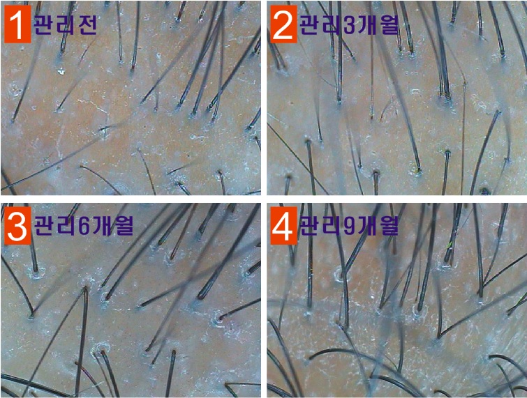 엠지에프두피탈모전문센터 이미지